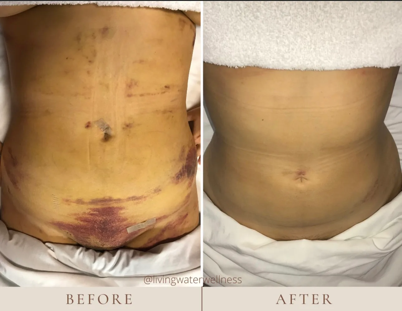 Consultation for Post Surgery