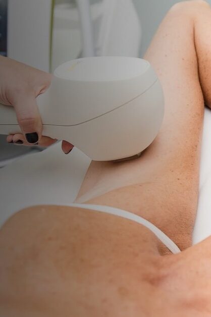 Consulations for Laser Hair Removal